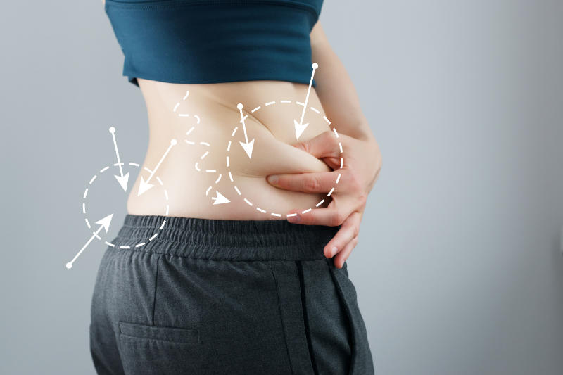 liposuction, yağ aldırma